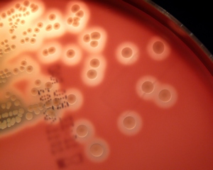 group A streptococcus